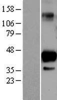 SIRT6 / Sirtuin 6 Protein - Western validation with an anti-DDK antibody * L: Control HEK293 lysate R: Over-expression lysate