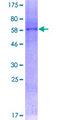 SIRT6 / Sirtuin 6 Protein - 12.5% SDS-PAGE of human SIRT6 stained with Coomassie Blue