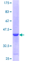 SIRT6 / Sirtuin 6 Protein - 12.5% SDS-PAGE Stained with Coomassie Blue.