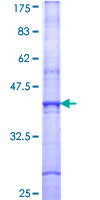 SIRT7 / Sirtuin 7 Protein - 12.5% SDS-PAGE Stained with Coomassie Blue.