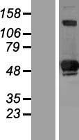 SIVA1 / SIVA Protein - Western validation with an anti-DDK antibody * L: Control HEK293 lysate R: Over-expression lysate