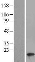 SIVA1 / SIVA Protein - Western validation with an anti-DDK antibody * L: Control HEK293 lysate R: Over-expression lysate