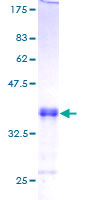 SIVA1 / SIVA Protein - 12.5% SDS-PAGE of human SIVA stained with Coomassie Blue