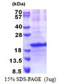 SIVA1 / SIVA Protein