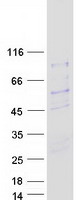 SIVA1 / SIVA Protein - Purified recombinant protein SIVA1 was analyzed by SDS-PAGE gel and Coomassie Blue Staining