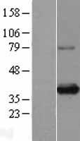 SIX1 Protein - Western validation with an anti-DDK antibody * L: Control HEK293 lysate R: Over-expression lysate