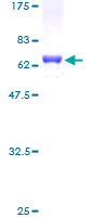 SIX1 Protein - 12.5% SDS-PAGE of human SIX1 stained with Coomassie Blue