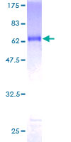 SIX2 Protein - 12.5% SDS-PAGE of human SIX2 stained with Coomassie Blue