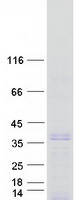 SIX2 Protein - Purified recombinant protein SIX2 was analyzed by SDS-PAGE gel and Coomassie Blue Staining