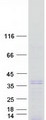 SIX2 Protein - Purified recombinant protein SIX2 was analyzed by SDS-PAGE gel and Coomassie Blue Staining