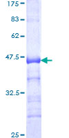 SIX4 Protein - 12.5% SDS-PAGE Stained with Coomassie Blue.