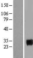 SIX6 Protein - Western validation with an anti-DDK antibody * L: Control HEK293 lysate R: Over-expression lysate