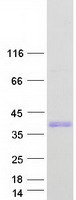 SKA1 Protein - Purified recombinant protein SKA1 was analyzed by SDS-PAGE gel and Coomassie Blue Staining