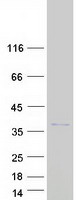 SKA1 Protein - Purified recombinant protein SKA1 was analyzed by SDS-PAGE gel and Coomassie Blue Staining