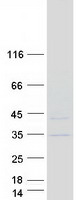 SKAP / HSD11 Protein - Purified recombinant protein KNSTRN was analyzed by SDS-PAGE gel and Coomassie Blue Staining