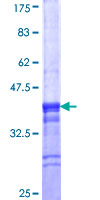 SKAP1 / SCAP1 Protein - 12.5% SDS-PAGE Stained with Coomassie Blue.