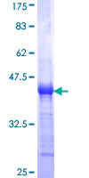 SKAP2 / SCAP2 Protein - 12.5% SDS-PAGE Stained with Coomassie Blue.