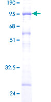 SKD1 / VPS4B Protein - 12.5% SDS-PAGE of human VPS4B stained with Coomassie Blue