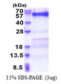 SKD1 / VPS4B Protein