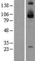 SKI Protein - Western validation with an anti-DDK antibody * L: Control HEK293 lysate R: Over-expression lysate