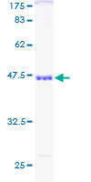SKP1 Protein - 12.5% SDS-PAGE of human SKP1A stained with Coomassie Blue