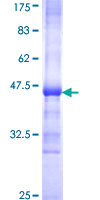 SKP1 Protein - 12.5% SDS-PAGE Stained with Coomassie Blue.
