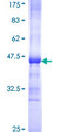 SKP1 Protein - 12.5% SDS-PAGE Stained with Coomassie Blue.