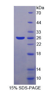 SKP1 Protein - Recombinant S-Phase Kinase Associated Protein 1 By SDS-PAGE