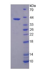 SKP2 Protein - Recombinant S-Phase Kinase Associated Protein 2 By SDS-PAGE