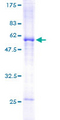 SLA Protein - 12.5% SDS-PAGE of human SLA stained with Coomassie Blue