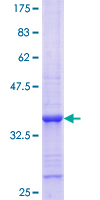 SLA Protein - 12.5% SDS-PAGE Stained with Coomassie Blue.