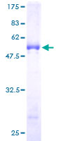 SLA2 / SLAP2 Protein - 12.5% SDS-PAGE of human SLA2 stained with Coomassie Blue