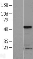SLAIN1 Protein - Western validation with an anti-DDK antibody * L: Control HEK293 lysate R: Over-expression lysate