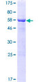 SLAIN2 Protein - 12.5% SDS-PAGE of human SLAIN2 stained with Coomassie Blue