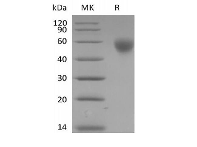 SLAMF1 / SLAM / CD150 Protein - Recombinant Human SLAM family member 1/SLAMF1/CD150 (C-6His-Avi) Biotinylated