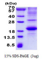 SLAMF1 / SLAM / CD150 Protein