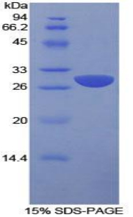 SLAMF1 / SLAM / CD150 Protein - Recombinant Signaling Lymphocytic Activation Molecule Family, Member 1 By SDS-PAGE
