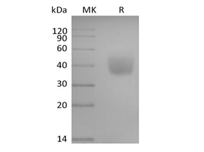 SLAMF6 / NTBA Protein - Recombinant Human SLAM Family Member 6/SLAMF6/CD352/NTB-A (C-6His-Avi) Biotinylated