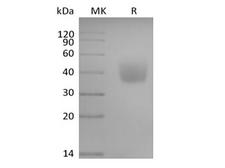 SLAMF6 / NTBA Protein - Recombinant Human SLAM Family Member 6/SLAMF6/CD352/NTB-A (C-6His-Avi) Biotinylated