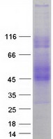 SLAMF6 / NTBA Protein - Purified recombinant protein SLAMF6 was analyzed by SDS-PAGE gel and Coomassie Blue Staining