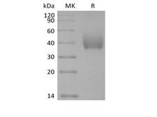 SLAMF7 / CRACC Protein - Recombinant Human SLAM Family Member 7/SLAMF7/CD319/CRACC (C-6His-Avi) Biotinylated