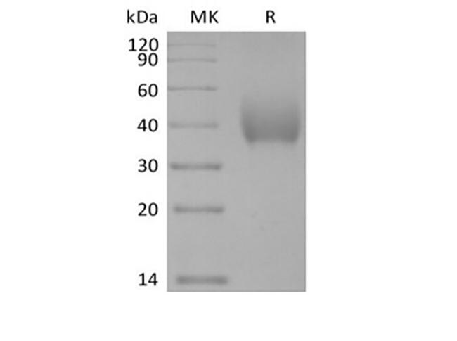 SLAMF7 / CRACC Protein - Recombinant Human SLAM Family Member 7/SLAMF7/CD319/CRACC (C-6His-Avi) Biotinylated
