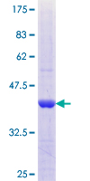 SLAMF7 / CRACC Protein - 12.5% SDS-PAGE Stained with Coomassie Blue.
