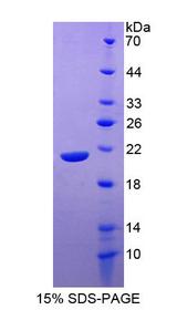 SLAMF7 / CRACC Protein - Recombinant Signaling Lymphocytic Activation Molecule Family, Member 7 By SDS-PAGE