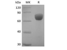 SLAMF7 / CRACC Protein - Recombinant Human SLAM Family Member 7/SLAMF7/CD319/CRACC (C-mFc)