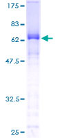 SLBP Protein - 12.5% SDS-PAGE of human SLBP stained with Coomassie Blue