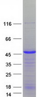SLBP Protein - Purified recombinant protein SLBP was analyzed by SDS-PAGE gel and Coomassie Blue Staining