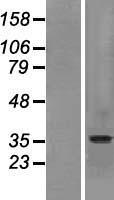 SLC10A2 / ASBT Protein - Western validation with an anti-DDK antibody * L: Control HEK293 lysate R: Over-expression lysate
