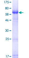 SLC10A4 Protein - 12.5% SDS-PAGE of human SLC10A4 stained with Coomassie Blue