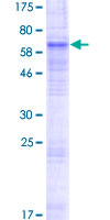 SLC10A6 Protein - 12.5% SDS-PAGE of human SLC10A6 stained with Coomassie Blue